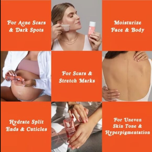 COPY - Bio-Oil Skincare Body Oil 6.7 fl oz Serum for Scars & Stretchmarks Face … - Picture 8 of 11